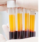 Cytokine-Related Aging Process